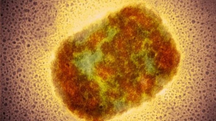 1-science-photo-library-1-