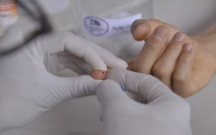 hiv