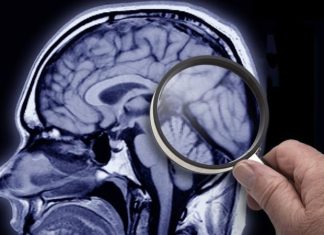 Cientistas descobrem uma nova estrutura no cérebro humano