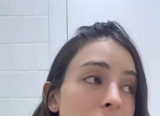 Bella Longuinho relata agressão do namorado e anuncia fim do relacionamento